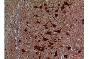 Immunohistochemistry (IHC) image for anti-Hexosaminidase A (HEXA) (Internal Region) antibody (ABIN3187766)