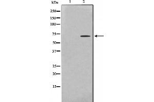 Western blot analysis on HeLa cell lysate using PHF1 Antibody. (PHF1 Antikörper  (Internal Region))