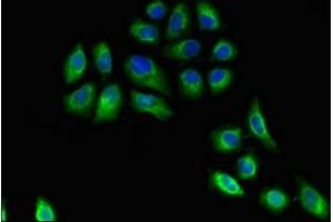 Immunofluorescent analysis of A549 cells using ABIN7155605 at dilution of 1:100 and Alexa Fluor 488-congugated AffiniPure Goat Anti-Rabbit IgG(H+L)