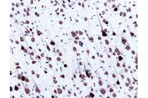 Immunohistochemical staining of pyrimidal cells in a rat cortex, formalin-fixed paraffin-embedded tissue section, with citrate pre-treatment (magnification, 20X) (center). (SNRPN Antikörper  (AA 14-174))