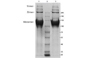 SDS PAGE Results of Bovine Collagen Type II. (COL2A1 Protein)