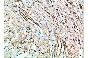 Immunohistochemical analysis of paraffin-embedded human-kidney, antibody was diluted at 1:200 (ART4 Antikörper  (AA 181-230))