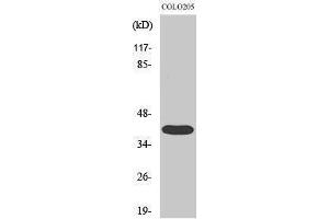 Western Blotting (WB) image for anti-Mitogen-Activated Protein Kinase-Activated Protein Kinase 3 (MAPKAPK3) (C-Term) antibody (ABIN3183087) (MAPKAP Kinase 3 Antikörper  (C-Term))