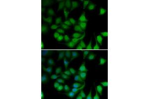 Immunofluorescence analysis of U2OS cells using POLR2H antibody (ABIN6292020). (POLR2H Antikörper)
