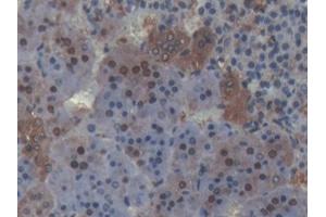 DAB staining on IHC-P; Samples: Rat Adrenal gland Tissue (PLSCR4 Antikörper  (AA 1-299))