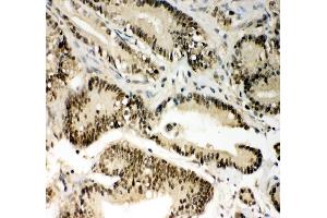 IHC analysis of PIN1 using anti PIN1 antibody (ABIN3042501).