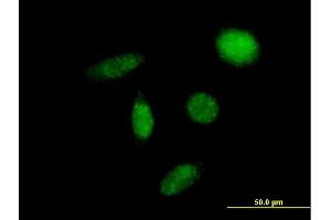 Immunofluorescence of purified MaxPab antibody to SLC29A2 on HeLa cell.