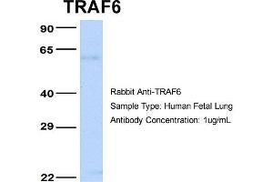 Host: Rabbit Target Name: TRAF6 Sample Type: Human Fetal Lung Antibody Dilution: 1. (TRAF6 Antikörper  (Middle Region))