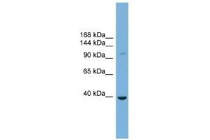 ST14 antibody used at 1 ug/ml to detect target protein.