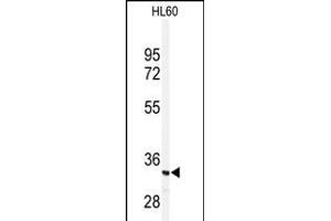 Western blot analysis of anti-PRKRA Antibody  (ABIN392151 and ABIN2841876) in HL60 cell line lysates (35 μg/lane). (PRKRA Antikörper  (AA 225-252))