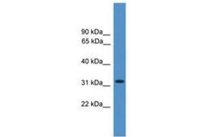 Image no. 1 for anti-Proteasome (Prosome, Macropain) Inhibitor Subunit 1 (PI31) (PSMF1) (AA 110-159) antibody (ABIN6745434)