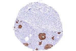 Strong cytoplasmic GAD2 staining of pancreatic islet cells (GAD65 Antikörper  (AA 6-99))