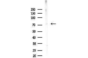 Western blot analysis of lysates from EC304 cells(heat-shock, 45 min treatment), using NuaK1 Antibody at 1/1000 dilution.