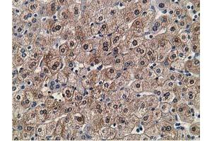 Immunohistochemical staining of paraffin-embedded Human liver tissue using anti-FLYWCH2 mouse monoclonal antibody. (FLYWCH2 Antikörper)