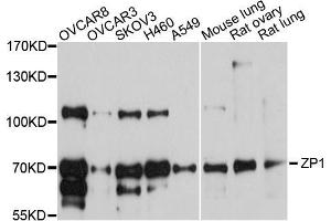 Western blot analysis of extracts of various cell lines, using ZP1 antibody (ABIN5999216) at 1/1000 dilution.