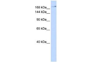 WB Suggested Anti-ZMYM4 Antibody Titration:  0. (ZMYM4 Antikörper  (N-Term))