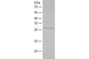 Western Blotting (WB) image for alpha-Methylacyl-CoA Racemase (AMACR) (AA 171-382) protein (His tag) (ABIN7121802)