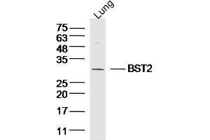 Mouse lung lysates probed with BST2/CD317 Polyclonal Antibody, unconjugated  at 1:300 overnight at 4°C followed by a conjugated secondary antibody at 1:10000 for 90 minutes at 37°C. (BST2 Antikörper  (AA 1-20))