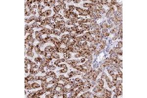 Immunohistochemical staining of human liver with SPINK9 polyclonal antibody  shows strong cytoplasmic positivity in hepatocytes at 1:20-1:50 dilution. (SPINK9 Antikörper)