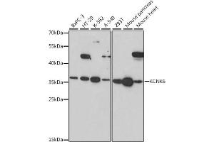 Western blot analysis of extracts of various cell lines, using KCNK6 antibody (ABIN7269467) at 1:1000 dilution.