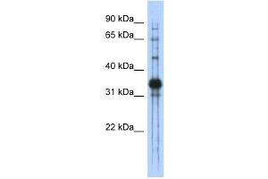 Chondroadherin antibody used at 1 ug/ml to detect target protein. (CHAD Antikörper  (Middle Region))