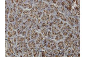 Image no. 1 for anti-Elastase 3A (ELA3A) (AA 16-271) antibody (ABIN599118) (Elastase 3A Antikörper  (AA 16-271))