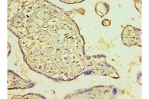 Immunohistochemistry of paraffin-embedded human placenta tissue using ABIN7162721 at dilution of 1:100 (PDLIM1 Antikörper  (AA 1-329))