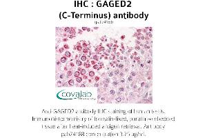 Image no. 2 for anti-X Antigen Family, Member 1B (XAGE1B) (C-Term) antibody (ABIN1734558) (XAGE1B/GAGED2 Antikörper  (C-Term))