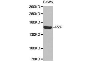 Western blot analysis of extracts of BeWo cell line, using PZP antibody. (PZP Antikörper  (AA 620-740))