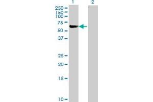Western Blot analysis of FANCC expression in transfected 293T cell line by FANCC MaxPab polyclonal antibody. (FANCC Antikörper  (AA 1-558))