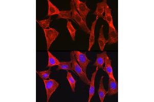 Immunofluorescence analysis of NIH/3T3 cells using D Rabbit pAb (ABIN6134076, ABIN6139403, ABIN6139404 and ABIN6224222) at dilution of 1:250 (40x lens). (DAPK2 Antikörper  (C-Term))
