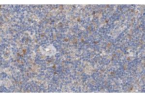 ABIN6266885 at 1/100 staining human lymph node tissue sections by IHC-P. (EGR1 + EGR2 Antikörper)