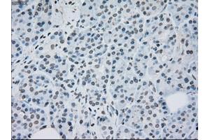 Immunohistochemical staining of paraffin-embedded lung tissue using anti-MAP2K2mouse monoclonal antibody. (MEK2 Antikörper)