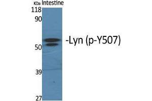 Western Blot (WB) analysis of specific cells using Phospho-Lyn (Y508) Polyclonal Antibody.