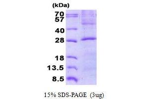 Image no. 1 for Golgi SNAP Receptor Complex Member 2 (GOSR2) protein (His tag) (ABIN6387147) (GOSR2 Protein (His tag))