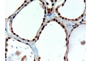 PAX8 polyclonal antibody  staining (3 ug/mL) of paraffin embedded human thyroid gland. (PAX8 Antikörper)