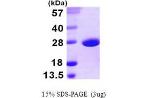 SDS-PAGE (SDS) image for SOD-A (AA 1-206) protein (His tag) (ABIN667439) (SOD-A (AA 1-206) protein (His tag))