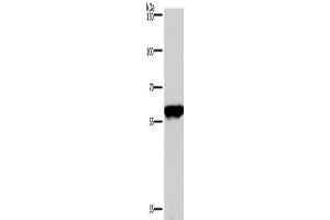 Western Blotting (WB) image for anti-Protein Phosphatase 3, Catalytic Subunit, alpha Isoform (PPP3CA) antibody (ABIN2429663)