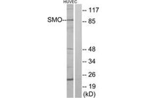 Western blot analysis of extracts from HuvEc cells, using SMO Antibody. (SMO Antikörper  (AA 68-117))