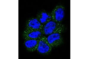 Confocal immunofluorescent analysis of NRAS Antibody (N-term) (ABIN392152 and ABIN2841877) with NCI- cell followed by Alexa Fluor 488-conjugated goat anti-rabbit lgG (green). (GTPase NRas Antikörper  (N-Term))