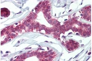 Human Breast (formalin-fixed, paraffin-embedded) stained with ELF4 antibody ABIN462321 followed by biotinylated goat anti-rabbit IgG secondary antibody ABIN481713, alkaline phosphatase-streptavidin and chromogen. (Elf4 Antikörper  (AA 211-237))