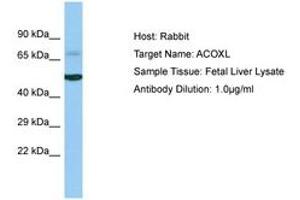Image no. 1 for anti-Acyl-CoA Oxidase-Like (ACOXL) (AA 263-312) antibody (ABIN6750230) (ACOXL Antikörper  (AA 263-312))