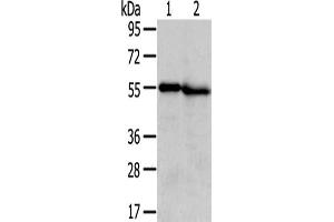 Gel: 8 % SDS-PAGE,Lysate: 40 μg,Lane 1-2: Human normal liver tissue, Human kidney tissue,Primary antibody: ABIN7131406(TMPRSS5 Antibody) at dilution 1/300 dilution,Secondary antibody: Goat anti rabbit IgG at 1/8000 dilution,Exposure time: 5 minutes