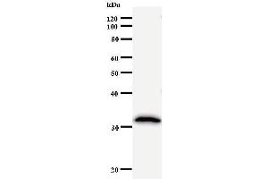 Western Blotting (WB) image for anti-Ubiquitin-Conjugating Enzyme E2K (UBE2K) antibody (ABIN931030)
