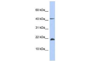 SFRS12IP1 antibody used at 1 ug/ml to detect target protein.