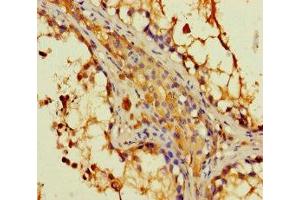 Immunohistochemistry of paraffin-embedded human testis tissue using ABIN7149562 at dilution of 1:100 (DAPL1 Antikörper  (AA 1-107))