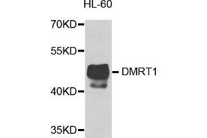 Western blot analysis of extracts of HL-60 cells, using DMRT1 antibody (ABIN5974586) at 1/1000 dilution. (DMRT1 Antikörper)