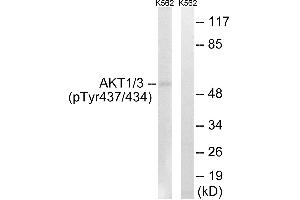 Immunohistochemistry analysis of paraffin-embedded human brain tissue using AKT1/3 (Phospho-Tyr437/434) antibody. (AKT1/3 (pTyr434), (pTyr437) Antikörper)