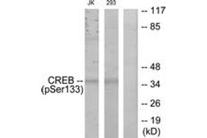 Western blot analysis of extracts from Jurkat and 293 cells treated with UV, using CREB (Phospho-Ser133) Antibody. (CREB1 Antikörper  (pSer133))