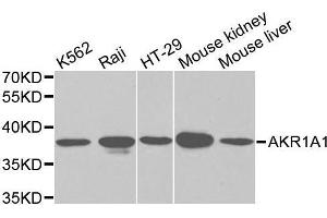 Western blot analysis of Y79 cell and Jurkat cell lysate using AKR1A1 antibody.